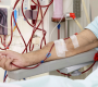 Dialysis procedure in Hyderabad