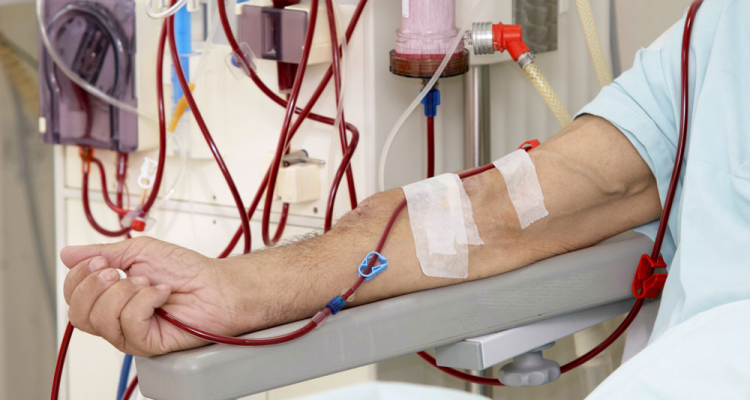 Dialysis procedure in Hyderabad