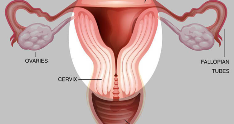 Hysterectomy Surgery in Hyderabad